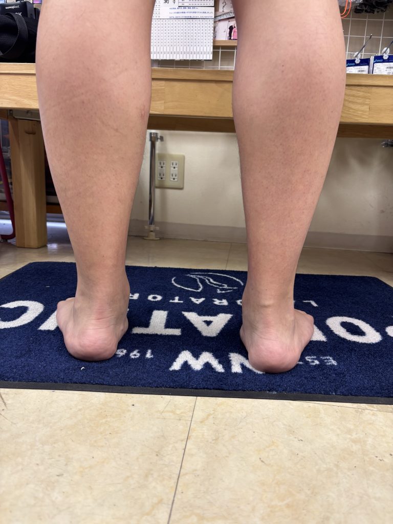 「膝の靭帯損傷、その原因を足元から考える」シューズとインソール【テニスショップ通販店長のブログ＠テニスショップLAFINO 西山克久】