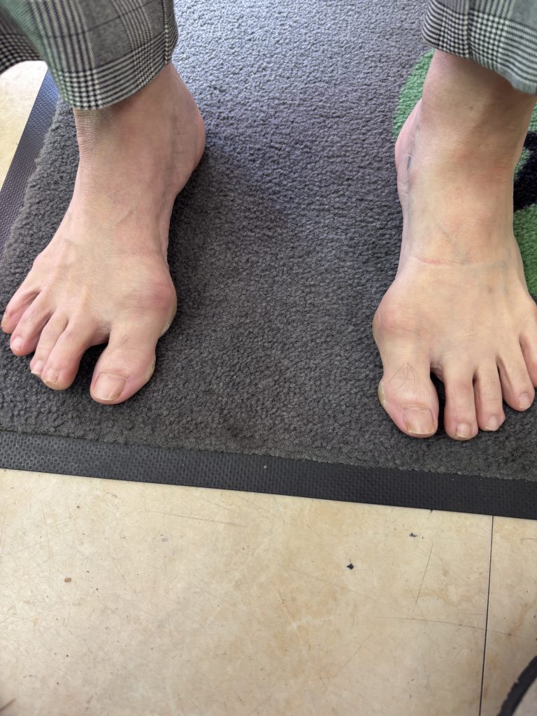 「母趾球神話の罠——まじめな人ほどハマる“内側使い”の危険性」【テニスショップ通販店長のブログ＠テニスショップLAFINO 西山克久】