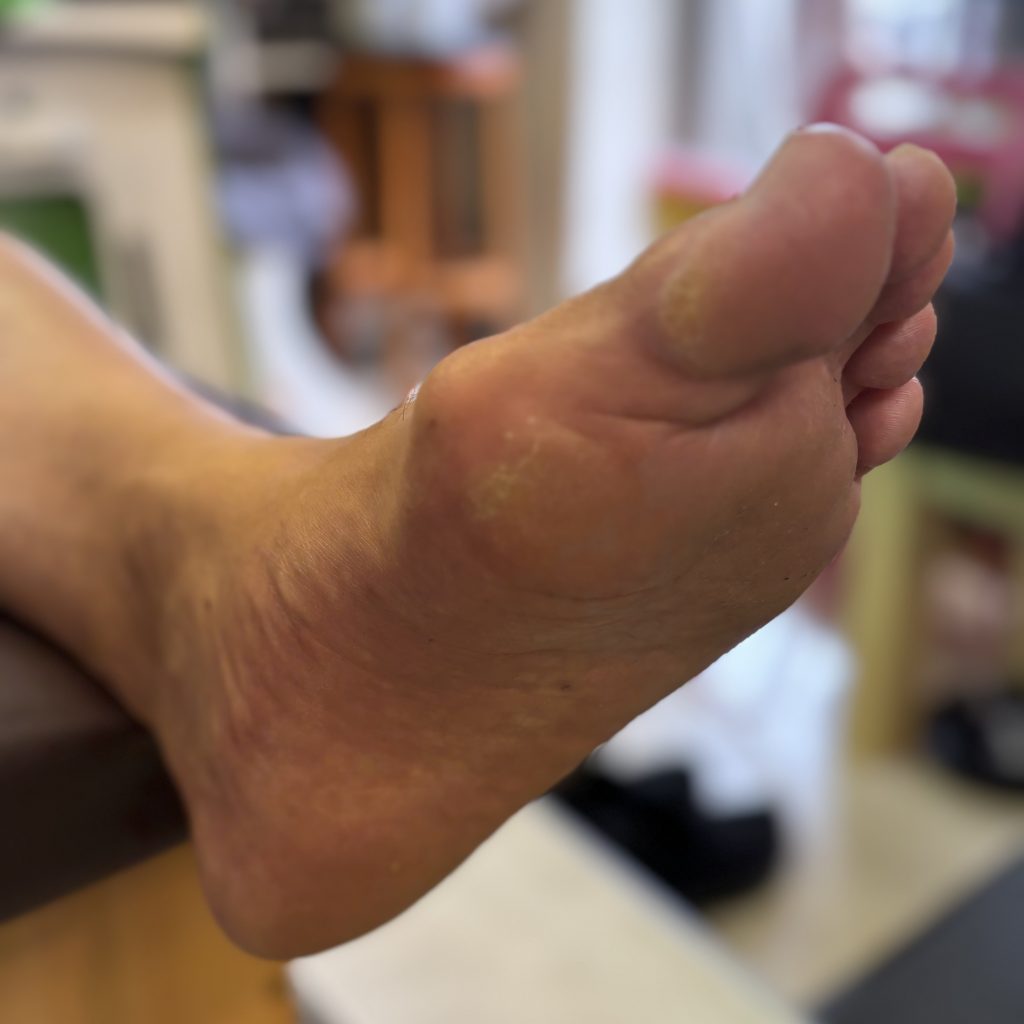 「インソールで人生が変わる？親子で見つけた改善の道」【テニスショップ通販店長のブログ＠テニスショップLAFINO 西山克久】