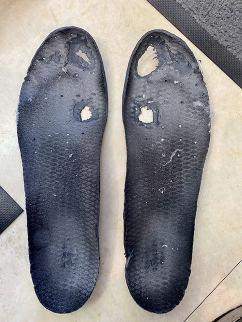 「母趾球お化け👻」がまた増殖中！？足の真実、知ってますか？【テニスショップ通販店長のブログ＠テニスショップLAFINO 西山克久】