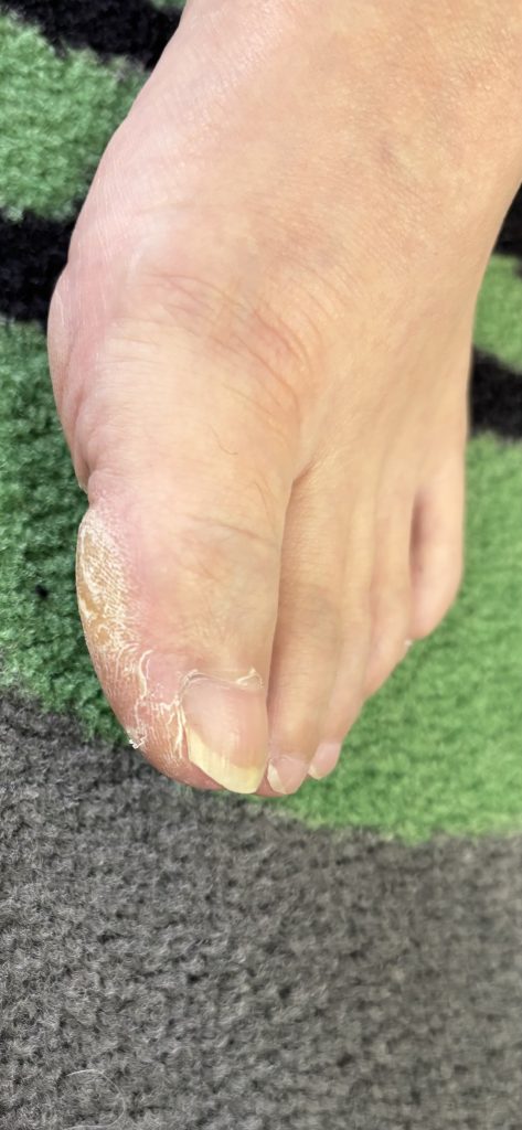 テニスは腰が疲れますよね。【テニスショップ通販店長のブログ＠テニスショップLAFINO 西山克久】