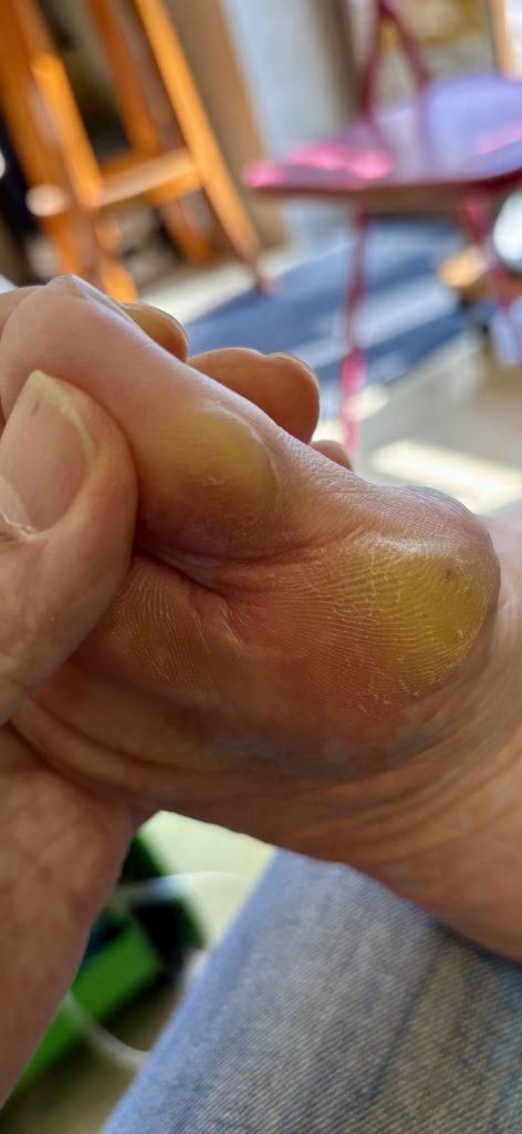 「母趾球神話の罠——まじめな人ほどハマる“内側使い”の危険性」【テニスショップ通販店長のブログ＠テニスショップLAFINO 西山克久】